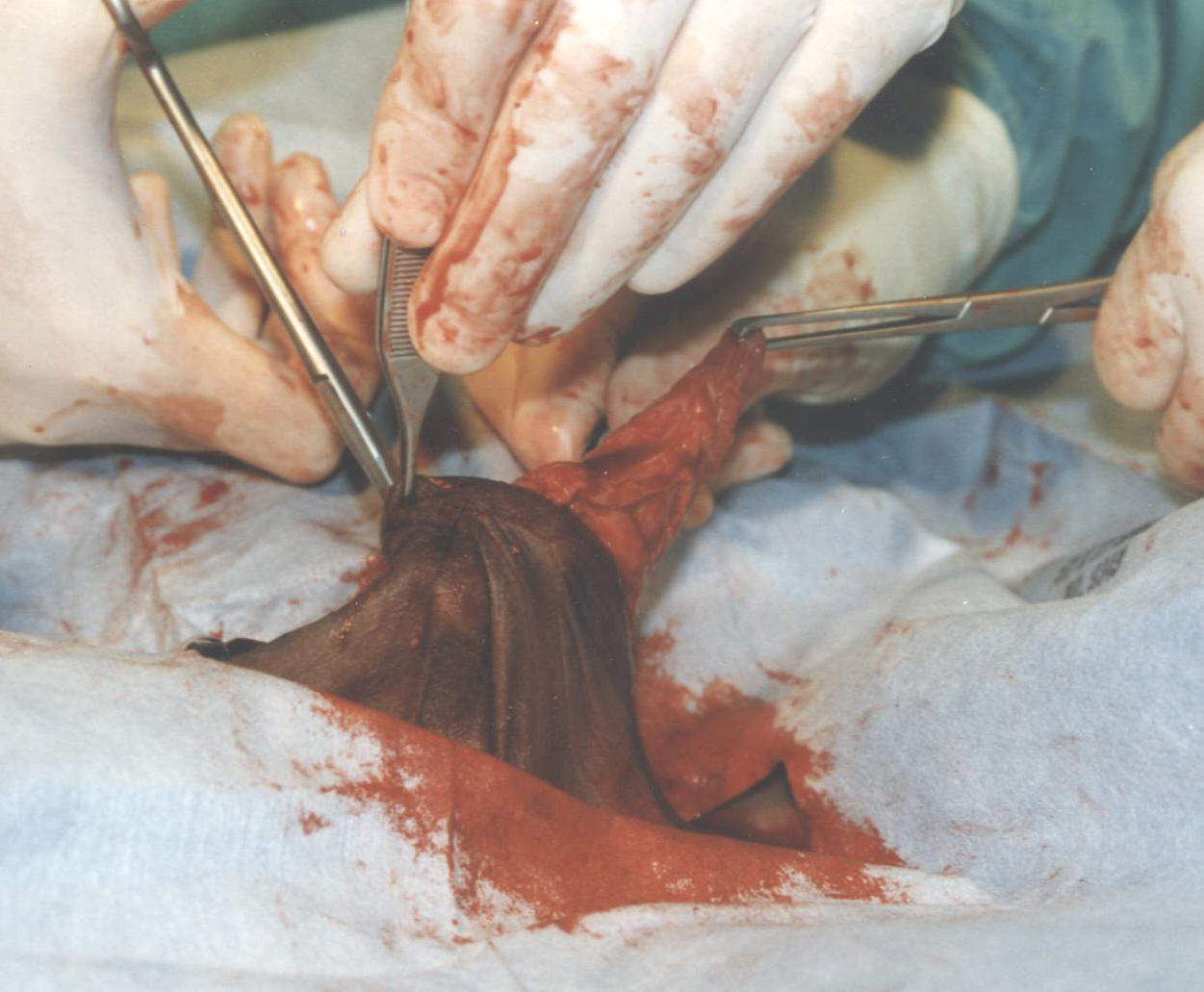 Veterianrian enters and begins to remove the subcutaneous fibrosis/hyperplasia.